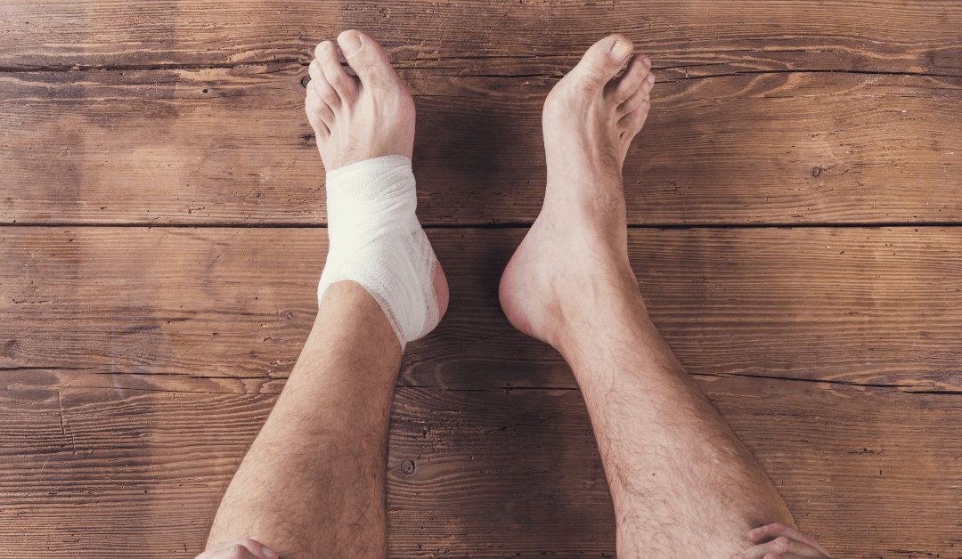 Are You Familiar With Hammer Toe Symptoms and Causes?