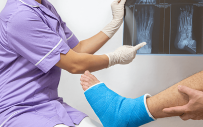 Tips For Identifying And Treating Heel Fractures